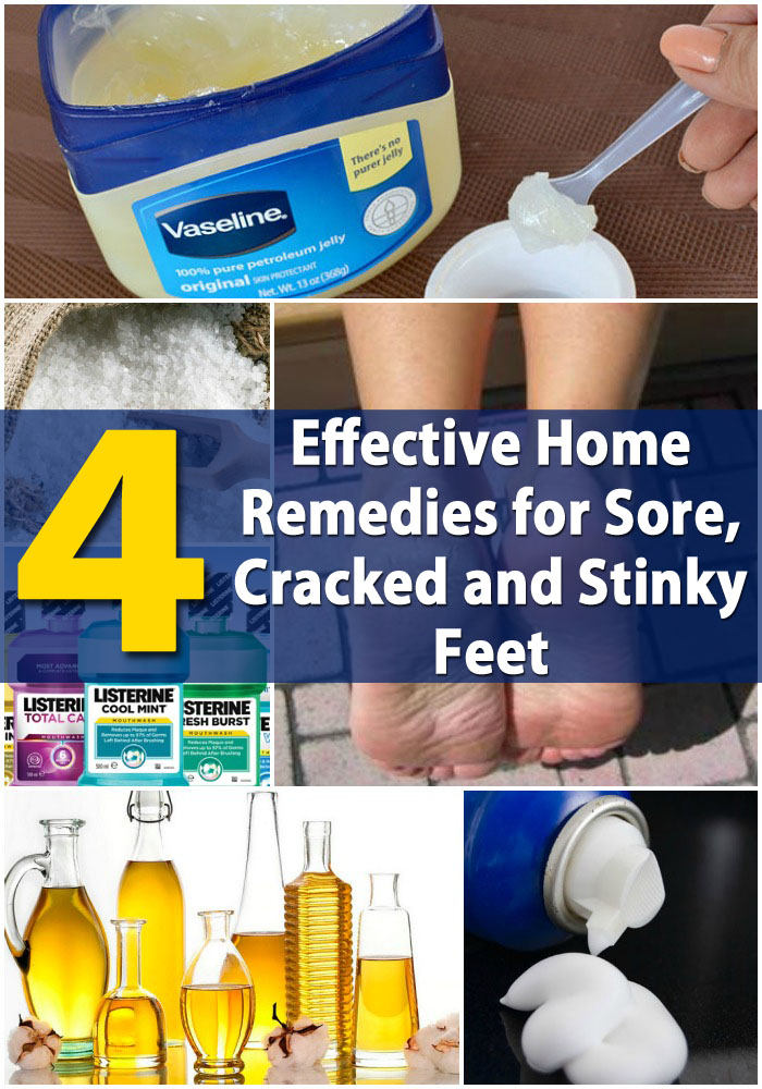 4 Effektive Home Remedies für Wunden, Cracked und Stinke Feet 