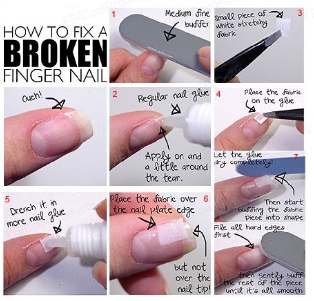 Schnelle und einfache DIY-Methoden zum Reparieren von gebrochenen oder gebrochenen Fingernägeln 