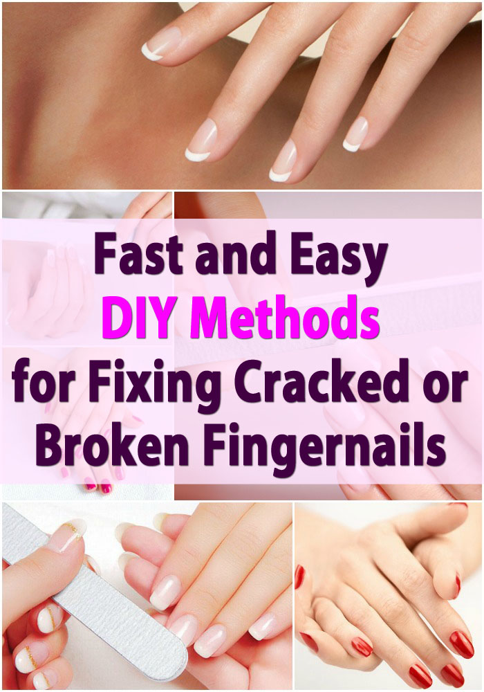 Schnelle und einfache DIY-Methoden zum Reparieren von gebrochenen oder gebrochenen Fingernägeln 