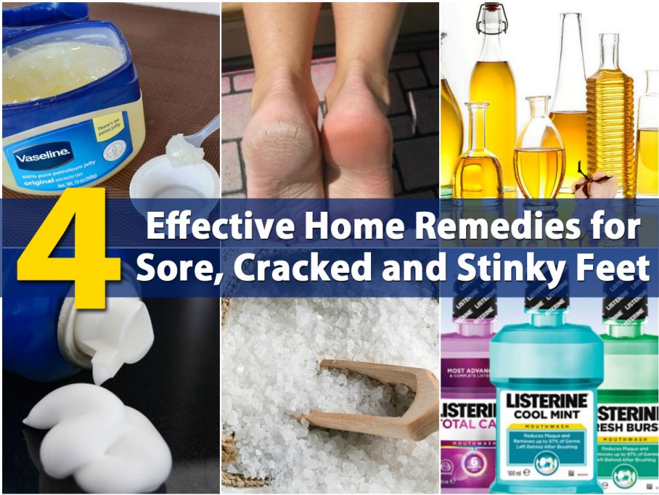 4 Effektive Home Remedies für Wunden, Cracked und Stinke Feet 