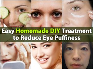 Einfache hausgemachte DIY-Behandlung zur Verringerung der Augenschwellung 